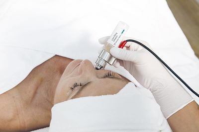 Nadelfreie Mesotherapie-Behandlung im Kosmetikinstitut Charisma